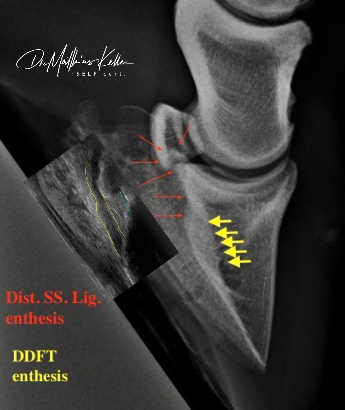 D966DE11 FFB1 4A86 992C 52A02187EFFB - Pferdesportpraxis: ligamentous navicular pain