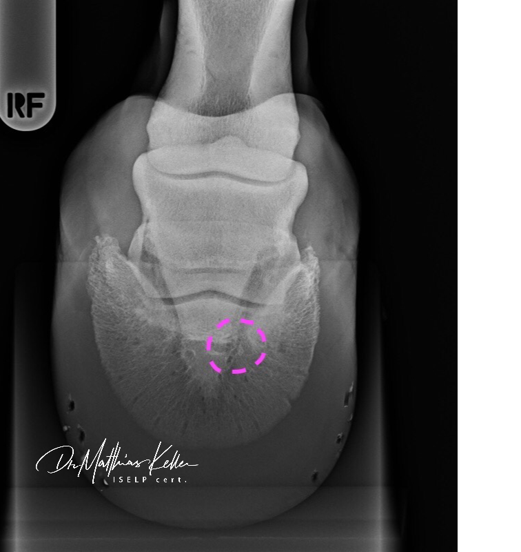 Pferdesportpraxis: ligamentous navicular pain, lesions 5BF06A3D CF6D 4162 946C 2565F583DFB1 2 - Pferdesportpraxis: ligamentous navicular pain, lesions